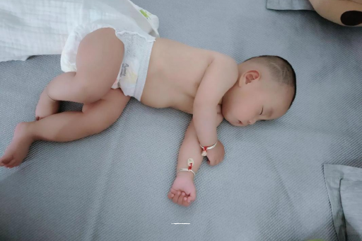 云浮六个月宝宝眼睛散光
